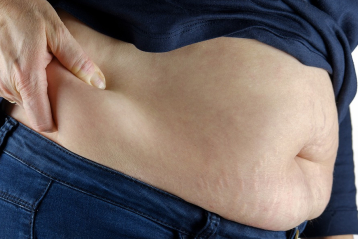 belly fat dementia risk